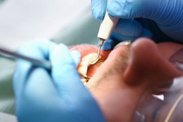 Best Pediatric Emergency Dentist in Clarks Summit, PA